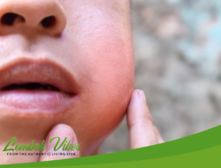 Ramai penyakit Denggong di Lombok Timur, apakah menular? Begini penjelasannya