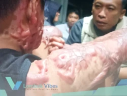 LPA Mataram bantah ancam keluarga korban, sayangkan konten kreator tanpa verifikasi fakta